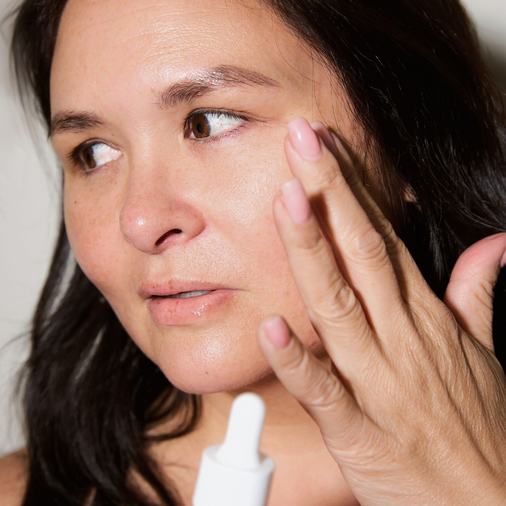 What Causes Adult Acne?